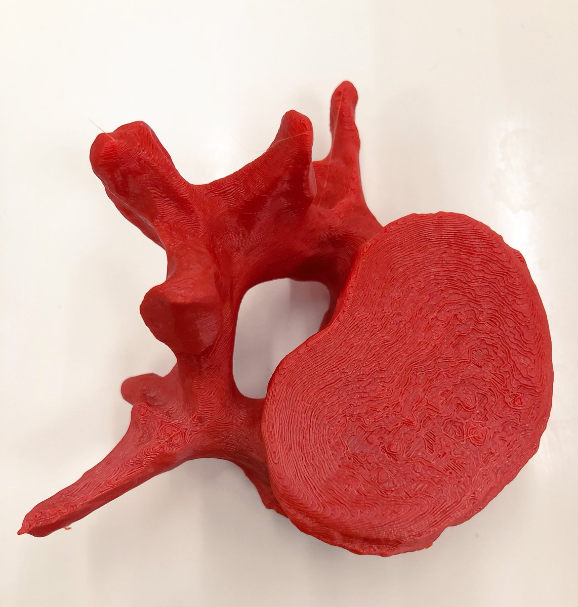 bowelsurgeon's tweet photo. Tadaaaa! (Ok, not mine..) but itโs very pretty! Thanks #transformmeded2018 @NTU_LKCMedicine https://t.co/CZmT5dj0zJ