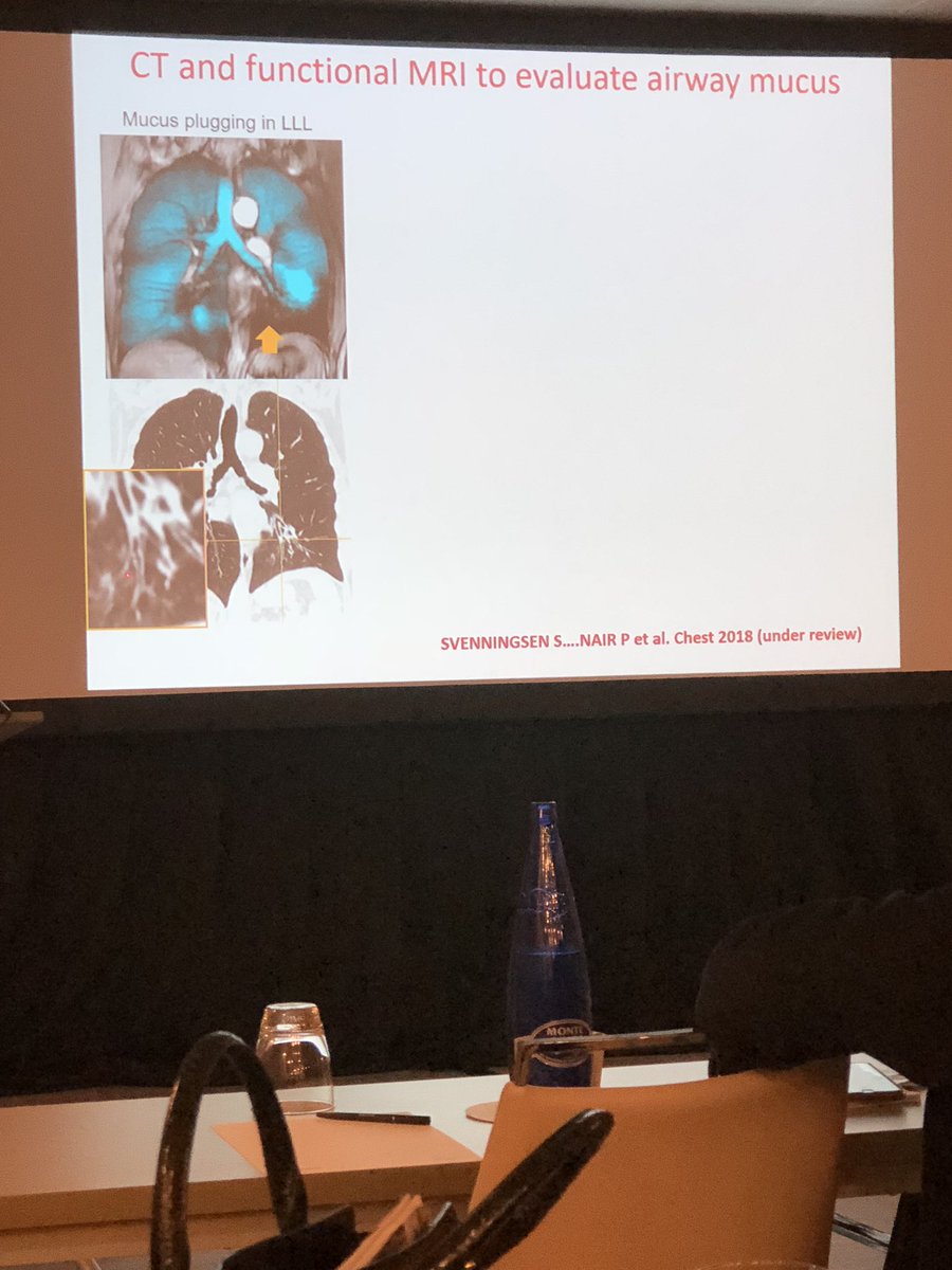 MarFdezNieto's tweet photo. Again terrific talk about #biologics in #severeasthma Dr Parameswaran #imagetechniques #isaf2018 @EAACI_HQ @EAACI_JM https://t.co/xXLtGM0tVx
