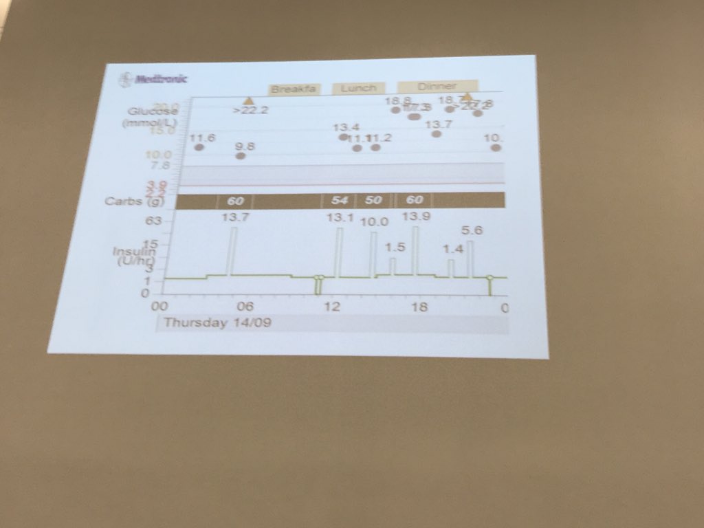 1Paulcoker's tweet image. @peterjjennings1 tells us that some days people with T1 have days when bg levels are in range, other days not so much and that’s OK #T1andTech