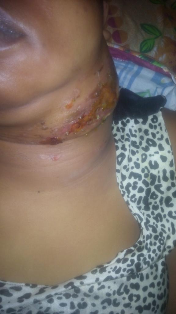 chrisdon4music's tweet photo. Dear sir/ma 
I try to do this all alone but I can't anymore so am screaming for help 
This is my junior sister she have under gone this surgery 2times before that is the reasons I can't promote my songs anymore all my money is gone to this anyhelp Will be appreciated pls Retweet https://t.co/y2fGcBgxOY
