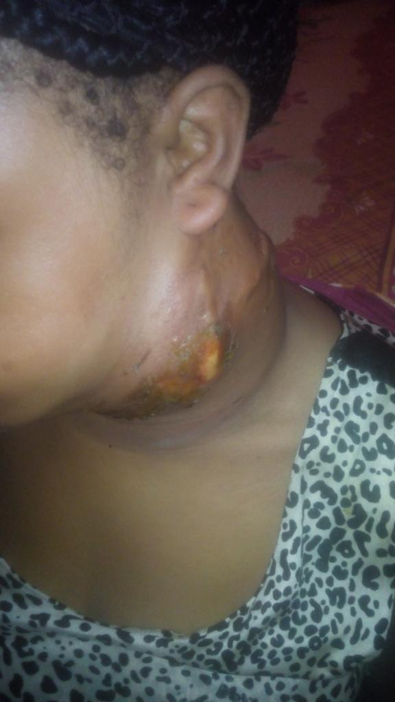 chrisdon4music's tweet photo. Dear sir/ma 
I try to do this all alone but I can't anymore so am screaming for help 
This is my junior sister she have under gone this surgery 2times before that is the reasons I can't promote my songs anymore all my money is gone to this anyhelp Will be appreciated pls Retweet https://t.co/y2fGcBgxOY