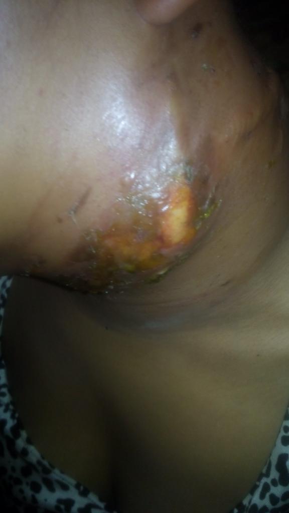 chrisdon4music's tweet photo. Dear sir/ma 
I try to do this all alone but I can't anymore so am screaming for help 
This is my junior sister she have under gone this surgery 2times before that is the reasons I can't promote my songs anymore all my money is gone to this anyhelp Will be appreciated pls Retweet https://t.co/y2fGcBgxOY