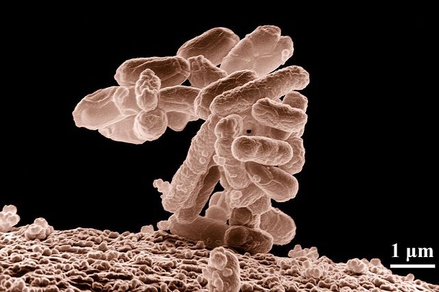 Get_Thrive's tweet photo. H7Test: A New Cure for Food Poisoning?
https://t.co/6mjbUsnEc8
#health #wellness #fitness #motivation #drdavecampbell https://t.co/SqzwIHitkN