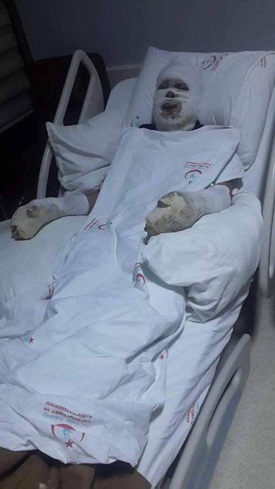 Hakkari Şemdinlide görevdeyken patlama sonucu vücutta yüzü kolları ayakları yanan subayımıza eşi dua istiyor

”Eşim Van askeri hastanede tedavi altına alındı lütfen yayınlayıp dua ister misiniz”

Ey merhameti ve rahmeti sonsuz olan Allahım
El Şafi isminle Şifalar ver
Amin ecmain