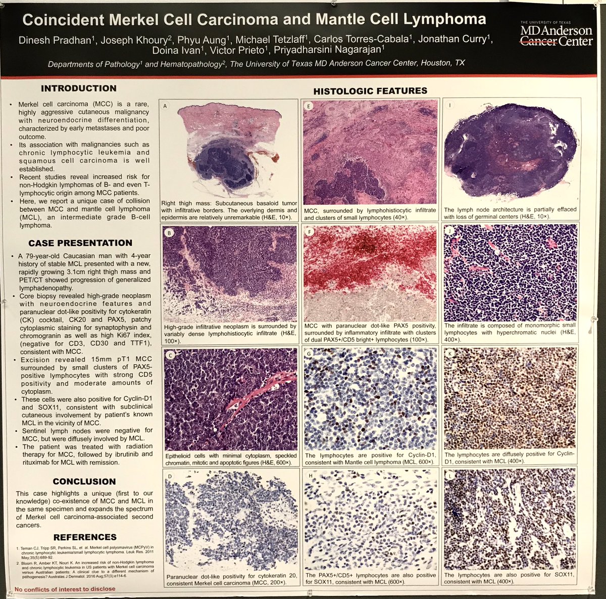 Dermpath L Great Posters Regarding Case 2 In The Second Poster I Suspect The Epithelial Component As Illustrated May Be Called Differently By Different Observers It Does Not Look Like An
