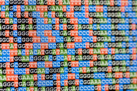 LEAD_Coalition's tweet photo. #Alzheimers and #cardiovascular disease share some genetic associations, including elevated LDL #cholesterol https://t.co/pMLEHe6M4l MT @POhukainen 

#cardiology #neurology #publichealth https://t.co/X8NCQGc84b