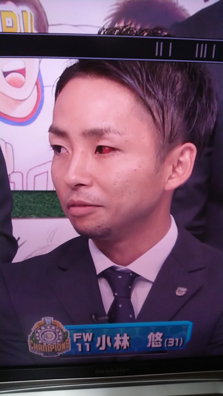 M N け 怪我 川崎フロンターレ 小林悠選手 やべっちfc T Co Qb4rpummdh Twitter M N け 怪我 川崎フロンターレ 小林悠選手 やべっちfc T Co Qb4rpummdh Twitter