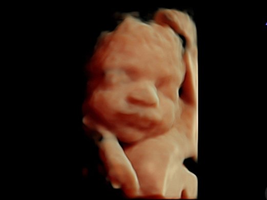 FutureBabiesLtd's tweet photo. Today we remember all the men and women who gave their lives in the hope that we, and all our future babies, would live in peace and freedom. They died for this little one, for you and for me. #lestweforget #chooselove https://t.co/UNrMieJOcq