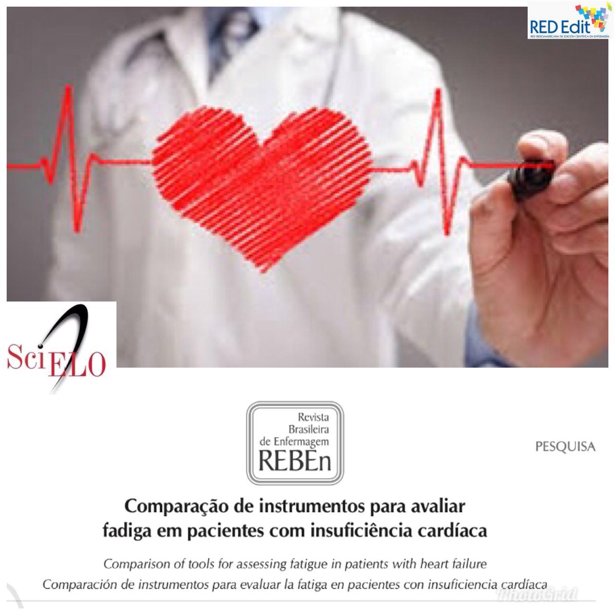 en_reb's tweet photo. COMPARAÇÃO DE INSTRUMENTOS PARA AVALIAR FADIGA EM PACIENTES COM INSUFICIÊNCIA CARDÍACA

Acesse a REBEn: https://t.co/xT6K9ARYEW 
COMPARISON OF TOOLS FOR ASSESSING FATIGUE IN PATIENTS WITH HEART FAILURE

#reben  #revistabrasileiradeenfermagem #aben #RedEdit  #Science #nursing https://t.co/fLETeae8HH
