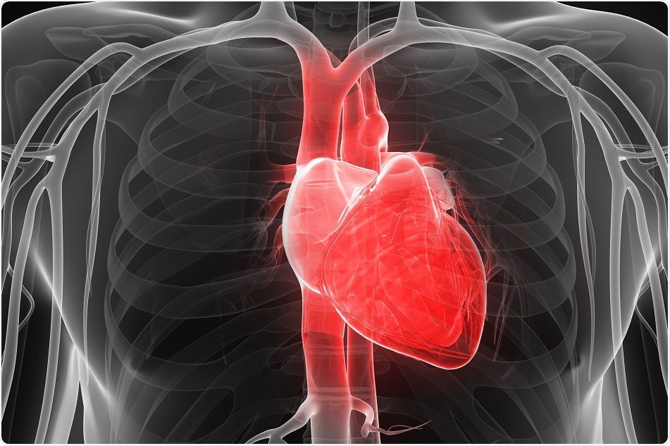 Сердце снизу. Миокардит и кардиомиопатия. Кардиомиопатия сердца что это такое.