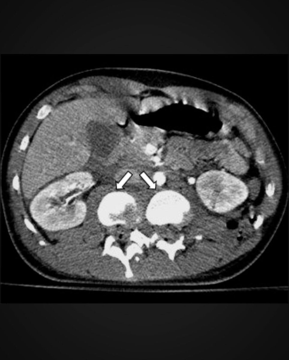 MiguelDlaCamara's tweet photo. Ponte el cinturón o puede pasarte como a esta mujer de 30 años que no lo llevaba antes del accidente de tráfico 
#SeguridadVial y #Radiología 

https://t.co/ZUswF13S5w https://t.co/qYkH35yZ2x