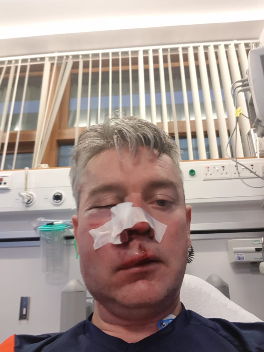 One of our Referees in Midland Branch today after a game was viciously attacked by players this should not be tollarted at all we as Referees doing a job no REF no game