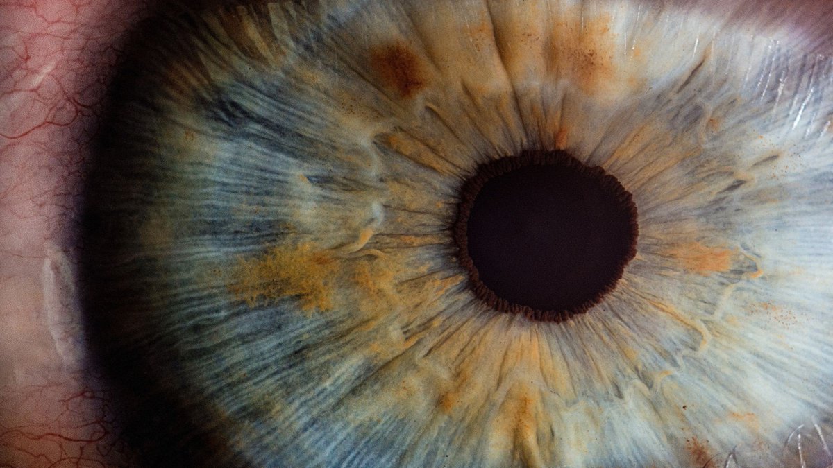 WorldTrendsInfo's tweet photo. Scientists develop nano-scale robot that 'drills' into eyes without damaging them: #ai #deeplearning #iot cc @Mikequindazzi https://t.co/1cNy3UiFSt https://t.co/IanS25TCYG
