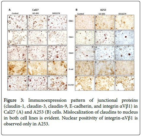 ClinExpPathol's tweet image. MUC1 and C-Met Affect Proliferation, Intercellular Junctions and Invasion in Two #Head and Neck #Carcinoma Cell Lines
omicsonline.org/open-access/mu…