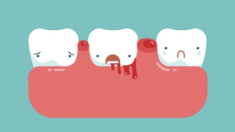 UCLEngage's tweet photo. Have a read of our latest guest blog from #CoProPilots team members Heather, Brian, Ian & Francesco... Who cares if bleeding gums worsen diabetes? Join them on 19 Nov! https://t.co/2GvsshuQkP #CoProduction https://t.co/v685LeWLSq