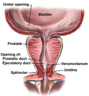 Prostatitis a latinul