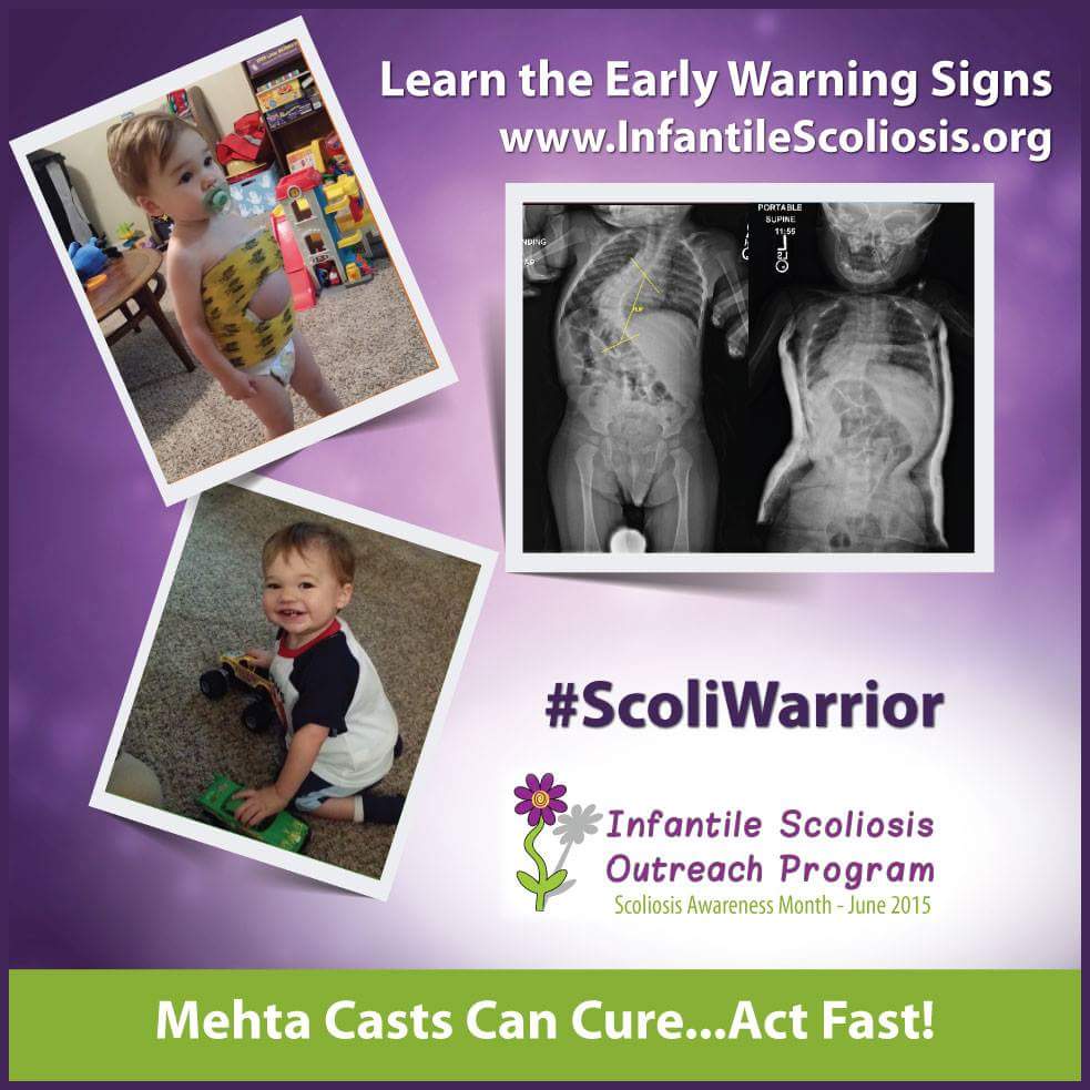 NatureGirlTech's tweet image. Jack is having surgery #22 on Fri. He wears permanent torso cast for rare spine disorder. As he gets older post-op is harder. Jack ADORES #turtles. Will anyone tweet fave turtle pics (you've taken) or facts/stories to him for after surgery? #Turtles4Jack #herpetology #herp