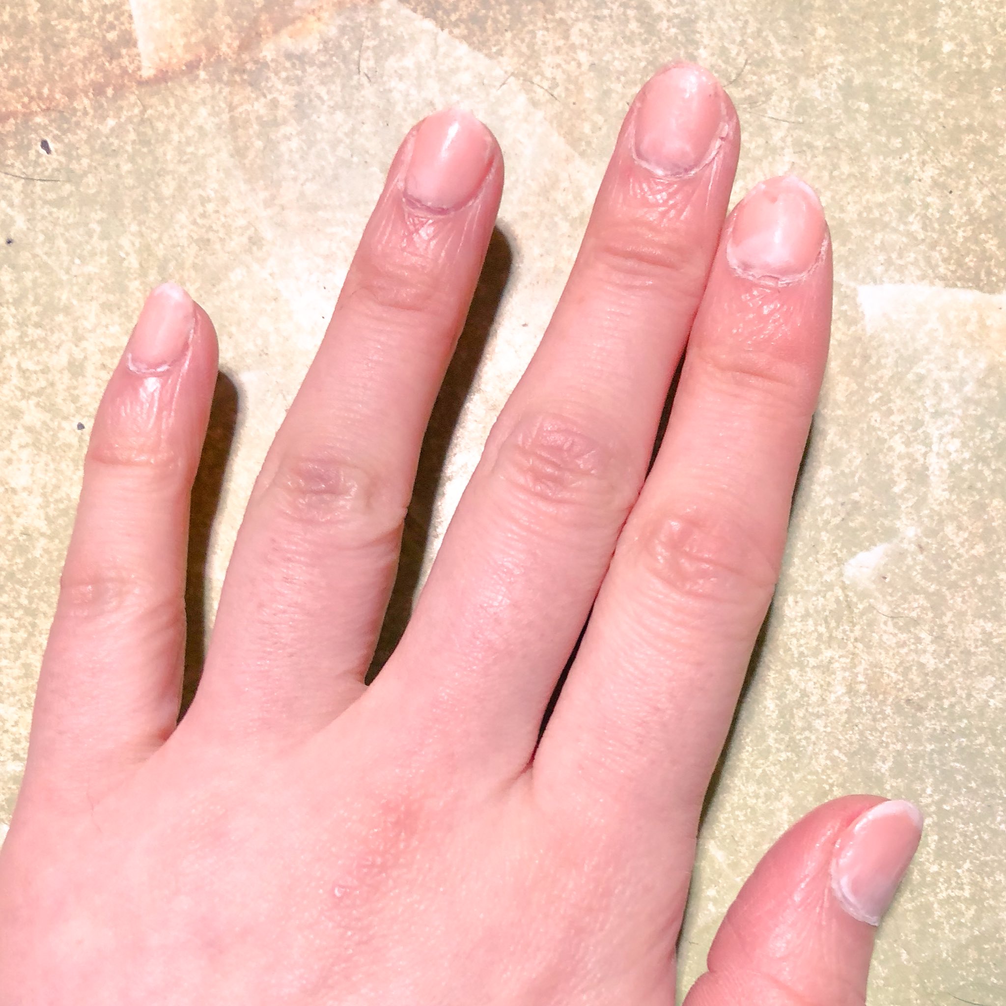 タダノヒトデ 一見 手入れを怠ってる汚い爪だが 剥がせるマニキュアの下にサロンでツヤツヤにしてもらったジェルネイルが隠れてるわけよ これぞニンジャネイル わいの会社 クソみたいな古い考えでマニュキア禁止で ジェルネイルも 爪