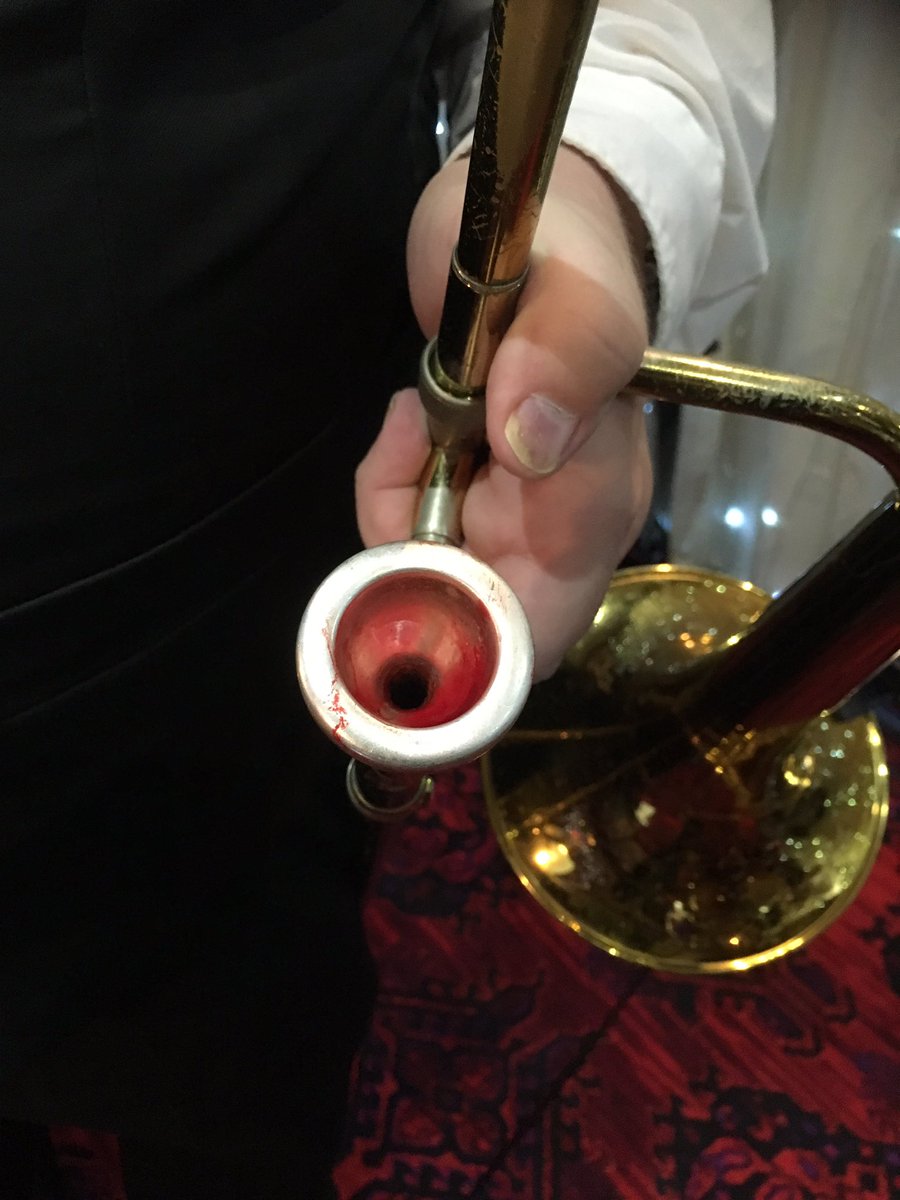 jamieblanc's tweet photo. Beautiful @GIBBSMUSIC splits lip during @Bynea_CC Xmas do, but soldiers on for the honour and glory of @WillisBand. Lip heals itself by end of gig. What a trouper. Yes that is lip blood. https://t.co/X2nhrJqHbk