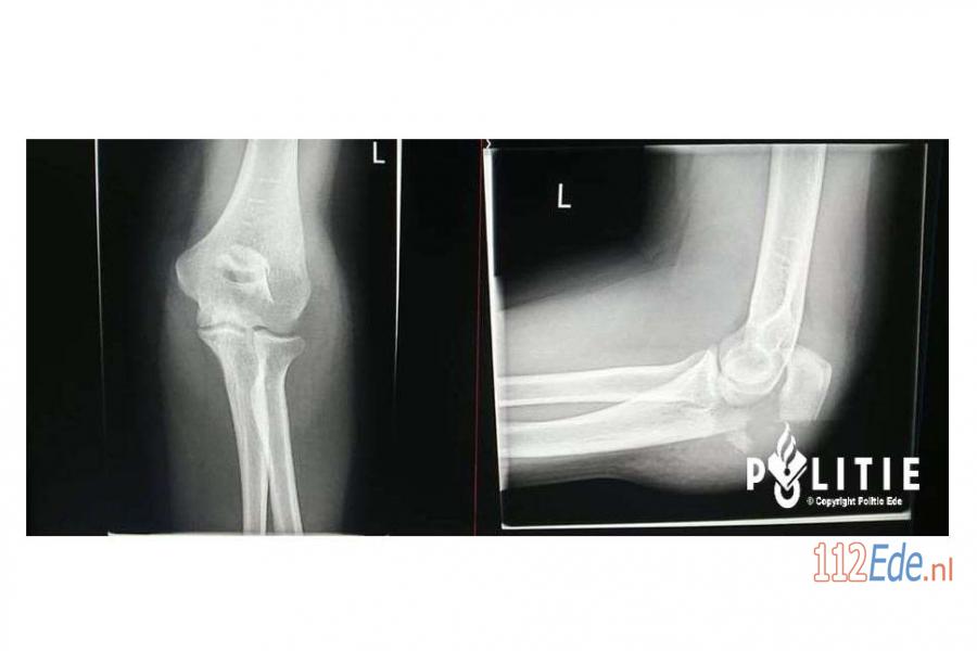 🚨 Automobiliste gezocht na aanrijding met fietsster in #Ede 112.press/Qs49HK 112Ede https://t.co/cJcWNYfgpC