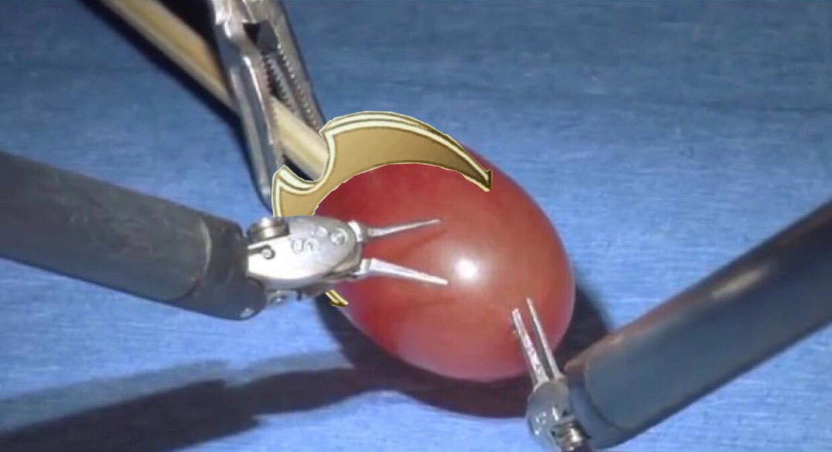 I’ve found a photo...
...of the Hero King Grape Marth, as they did surgery on him.