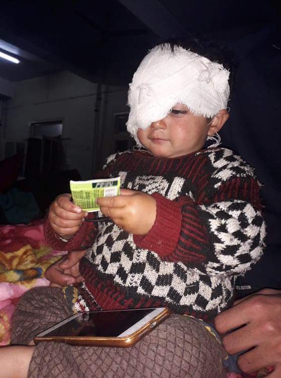 Baby hiba with pellet wounds in her eye!How it hurts to see her like this Pray for her speedy recovery ! The price that even our babies are paying as the conflict continues..