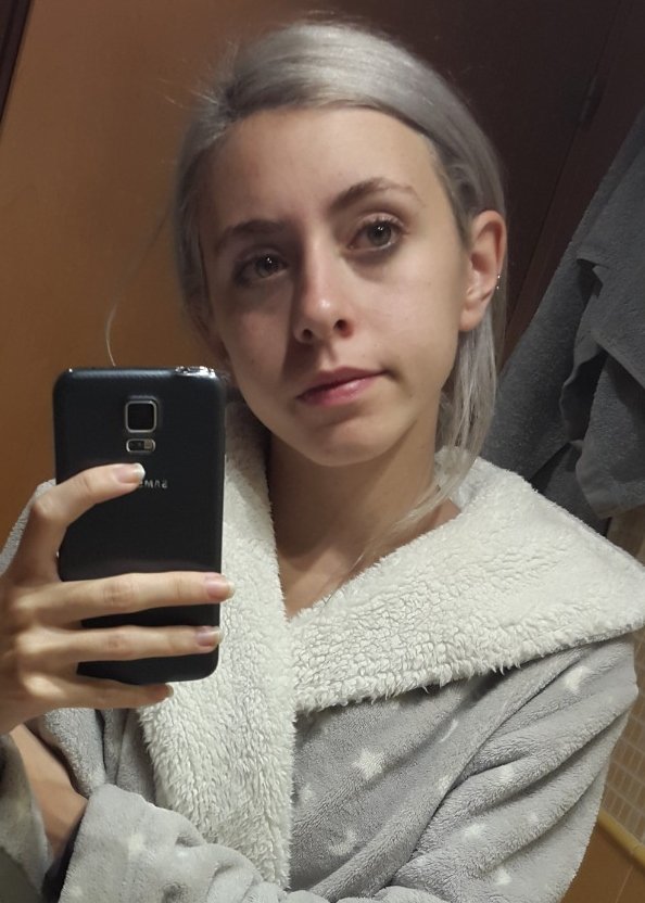 MIAREsproject's tweet photo. Así me quedé yo, tras mi relación de maltrato. 
Rozando los 40kg con 18 años, me ponía constantemente enferma y estaba agotada mentalmente.

Cualquiera con dos dedos de frente puede ver que algo no iba bien, que me estaba consumiendo. Y aun soy cuestionada y juzgada a diario. https://t.co/T7COjEAGuq