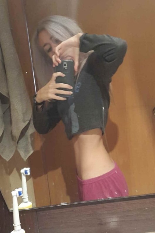 MIAREsproject's tweet photo. Así me quedé yo, tras mi relación de maltrato. 
Rozando los 40kg con 18 años, me ponía constantemente enferma y estaba agotada mentalmente.

Cualquiera con dos dedos de frente puede ver que algo no iba bien, que me estaba consumiendo. Y aun soy cuestionada y juzgada a diario. https://t.co/T7COjEAGuq