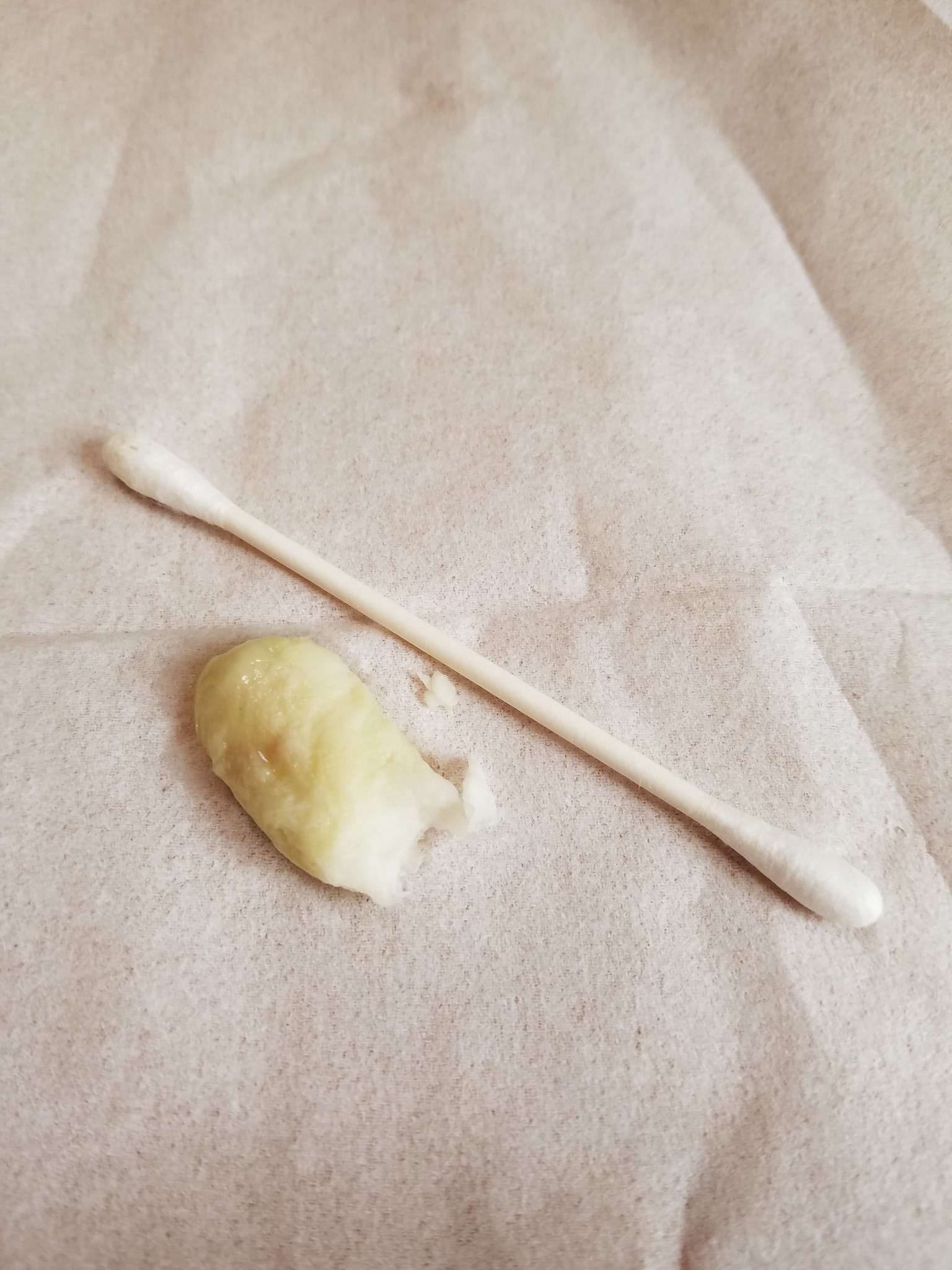 タンタン タンタン が鼻づまりで苦しそう 鼻クチョを取ってあげたら取っても取っても出てくる白い鼻クチョに家族がビックリ 小さな鼻の奥の方から こんなん出て来て２度ビックリ 鼻水を止める為に詰めたらしい 白い鼻くそ 白い恋人