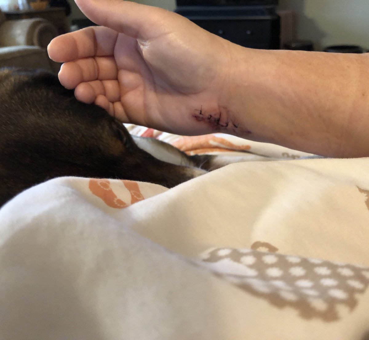 AprilBetzer's tweet photo. Freedom! And the first thing I did was pet my furry baby. Missed that feeling. #onthemend #205bones #superstiff #readytogetthestitchesout
Have to give a shoutout to JK. I canโt imagine walking and/or dancing on stitches. I am obviously a wimp. ๐๐ https://t.co/xnjUZgZ8Au