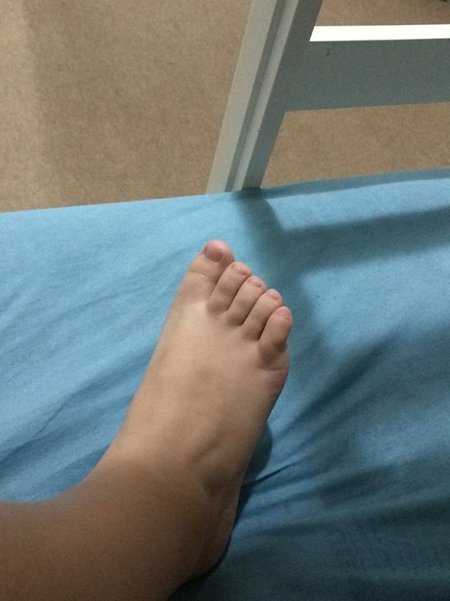 Isabella Garcia On Twitter Pior Que Pe De Anao