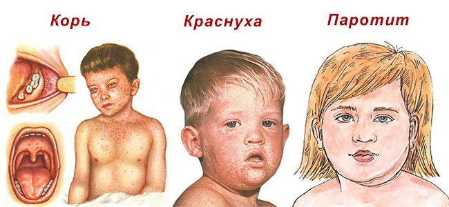 Лечение