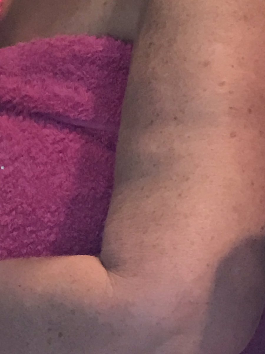 julesserkin's tweet photo. @ThyroidAction @ThyroidTrust @53Sally @thyroiduk_org When I can get an appointment- thing is it’s so laborious doingvthat “ everyone ‘phone up at 8am “ held in a queue lark -its on my list for tomorrow - since starting #NatureThroid (1year ) so maybe it doesn’t suit me 🙄 https://t.co/TDy7Eb9xZe