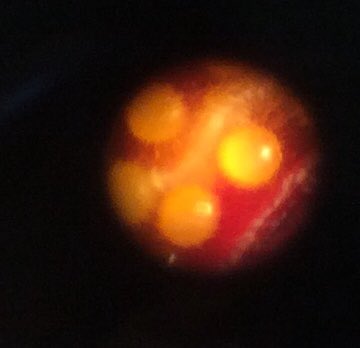 TBSYear3's tweet photo. How exciting! 3B have been in secondary this afternoon to explore the inside of flowers - we even learned how to use the microscopes! Look at the pollen we found! @The_IPC @TBS_IPC @TBSbiology https://t.co/9VFhyc1Vtw