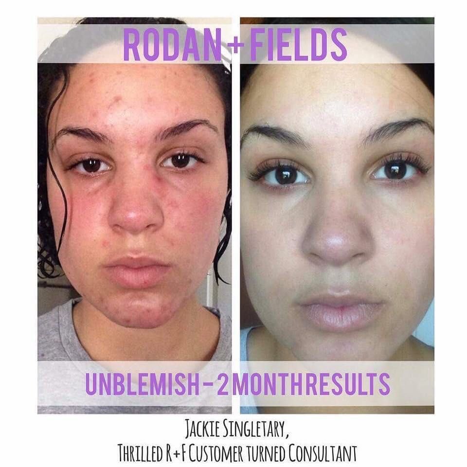 slightly_sarah's tweet photo. Super deals going on today. If you ever wanted to try Rodan + Fields, do it now and start aging backwards. #betterskinnow #rodanandfields #skincare #agebackwards #MotivationMonday #slightlysarahskincare #moneybackquarentee https://t.co/4os3ra6XyU https://t.co/JLyaSmBIH6