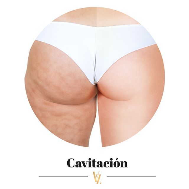 VictoriaBeautyH's tweet photo. ▶️¿Conoces la #cavitación?◀️ Es una técnica no quirúrgica para eliminar la grasa localizada mediante el uso de ultrasonidos de baja frecuencia. 🔝
¿Te interesa? 📞 ¡Llámanos y te contamos en detalle! 91 867 59 41
https://t.co/PiH5OGcsGB
#Tratamientos #Cavitación #Belleza #Est… https://t.co/f0QgbZel2t