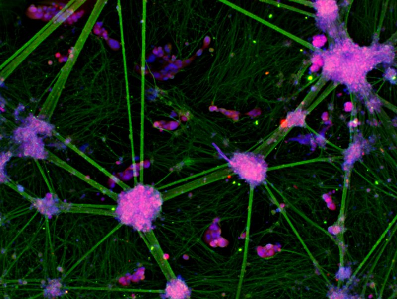 We can collect new bio-samples from disease relevant backgrounds to produce #iPSC lines to meet your research requirements. This is completed under our ethical, legal and data management systems which allow both academic and commercial research #drugdiscovery #stemcells #pharma