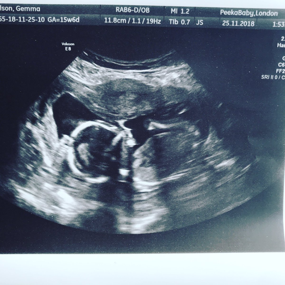 gem_lou22's tweet photo. A little baby boy 💙👩‍👧‍👦👨‍👧‍👦 https://t.co/zy9uwpjmyt