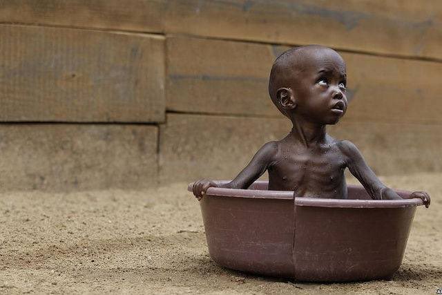 decarnemadelei1's tweet photo. Jérôme jarre lance un appel pour venir en aide à la Somalie. La sécheresse qui y sévit fait planer un risque de famine .. #Prayforsomalie #lovearmyforrohingyas https://t.co/6QViBJIvuF