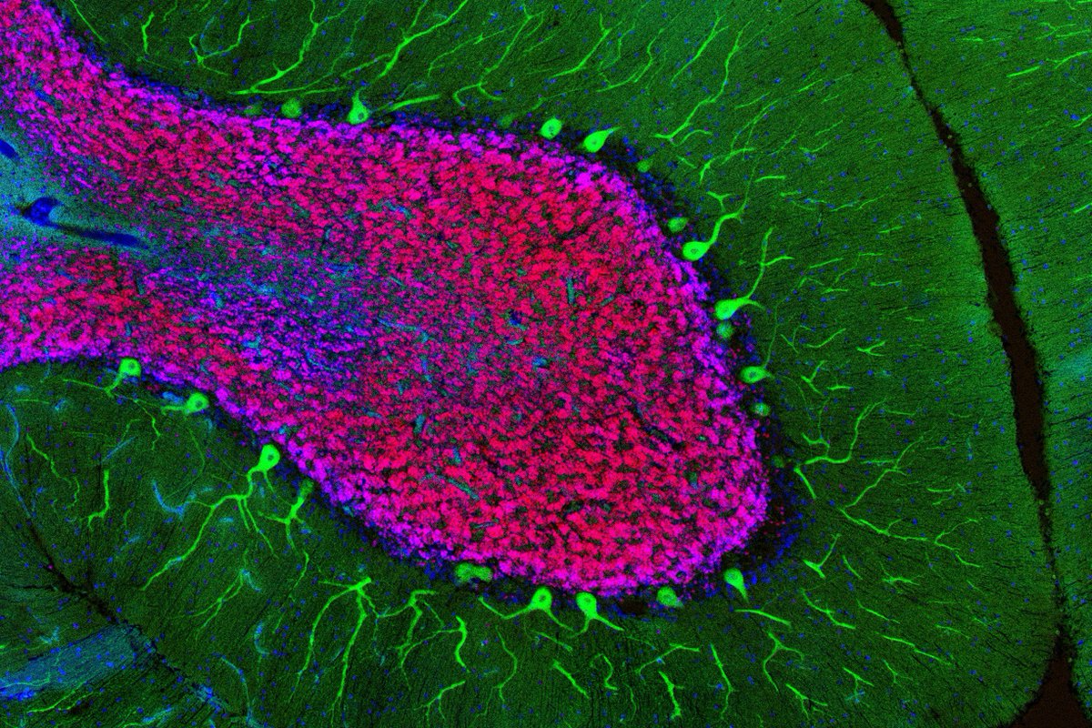 RockefellerUniv's tweet photo. By analyzing gene expression patterns, researchers in the #HeintzLab have identified previously unknown distinctions between mouse and human neurons. They have also developed a new way to track cellular changes associated with brain disorders. https://t.co/LaAquwdpvz https://t.co/oIls0JzPO1