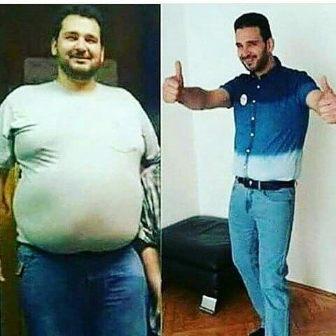 samar9939's tweet photo. لكل من يعاني من الدهون والترهلات
الان افضل حل مع افضل برنامج تخسيس عالميا
لاتواصل والاستفسار عبر الخاص

#اسمك_الحقيقي https://t.co/rdg1ZhIKff