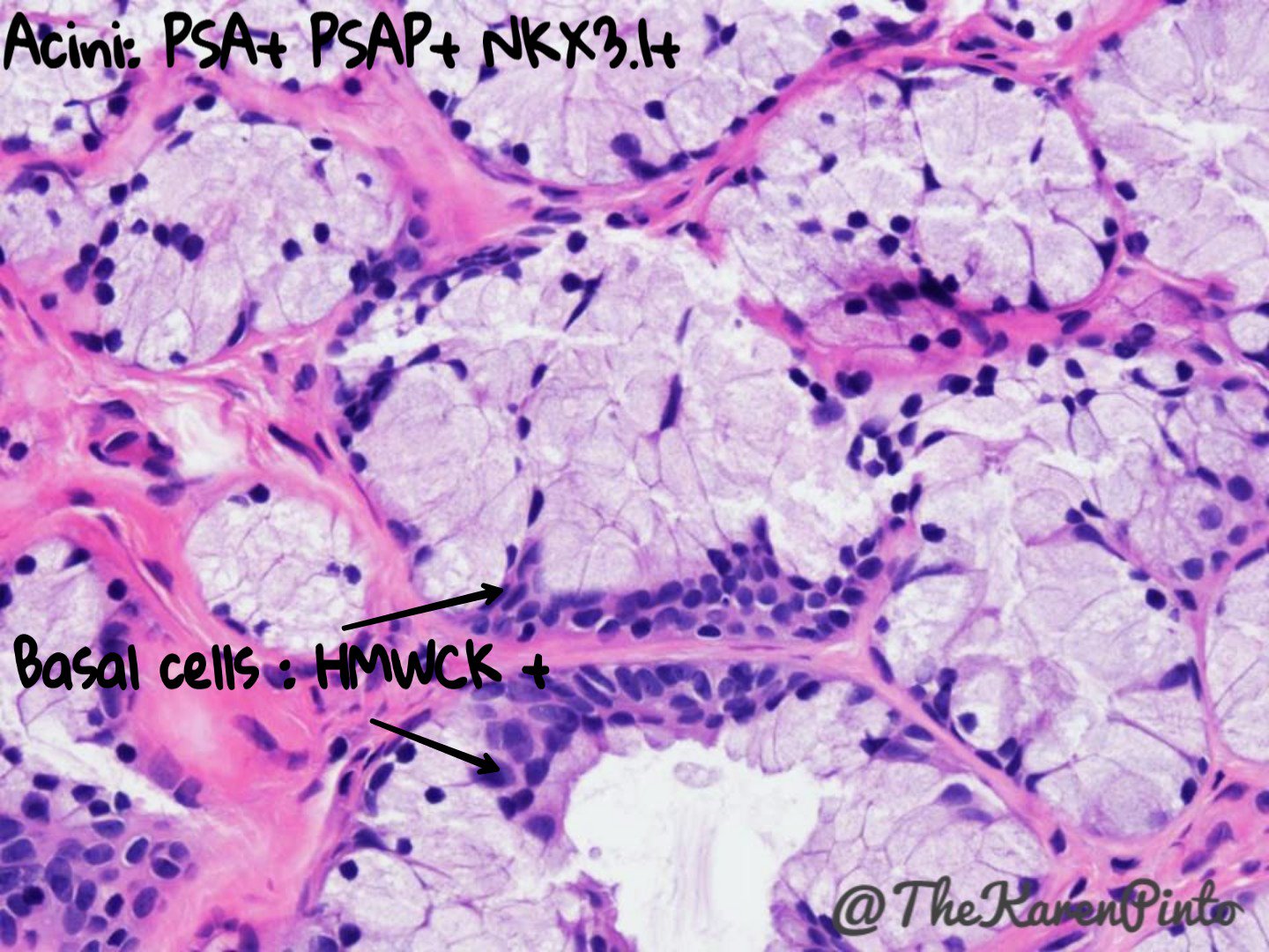 Karen Pinto DNB, FRCPath on Twitter "COWPER'S GLANDS When you get