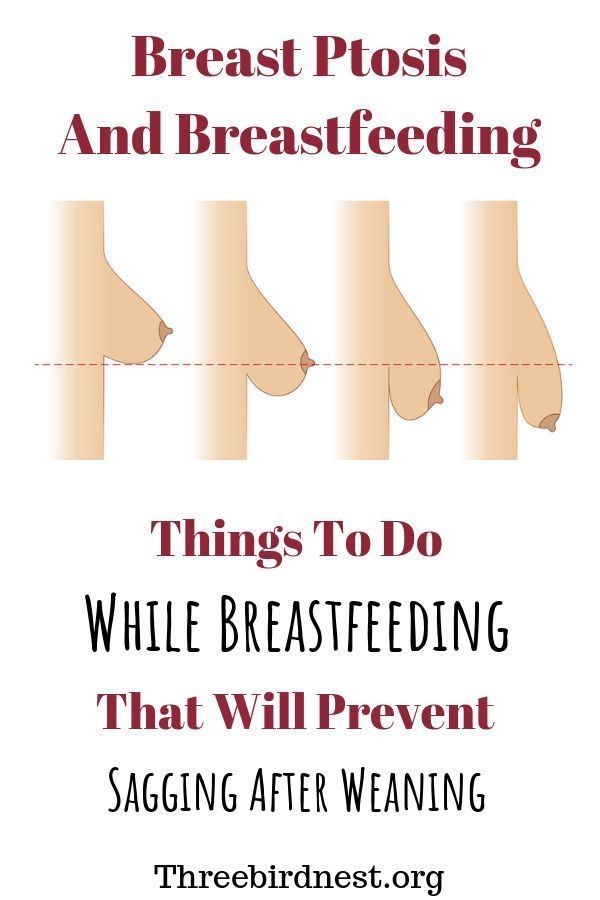 victoriaeyog on X: Just Pinned to Breastfeeding: Prevent Sagging Breast  While Breastfeeding #breastfeeding #Fixsaggybreasts #breastfeedingtips  #breastfeedingproblems   / X