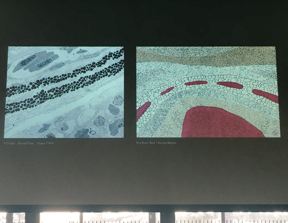 matilda_hd's tweet image. Starting Day 2 of #FutureMicrobiome2018: Jenny Whiting speaks about a wonderful exhibition of #micrographs and Aboriginal Australian #art she has curated. Check it out here: micro.org.au/storiesandstru…