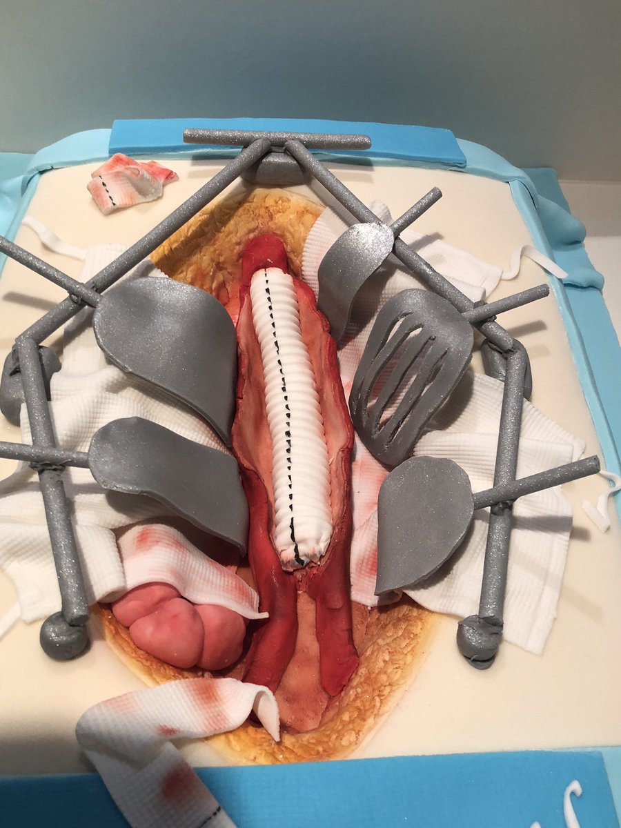 martinswadley's tweet photo. One of our hugely experience vascular theatre nurses leaves tomorrow after 40+yrs in the NHS. Got a sneak peak of her retirement cake. Awesome!! The swabs are icing as well! #icingomnitract😃👏🏻👋🏻🎂
@WorcsAcuteNHS @hummingbird1969 https://t.co/rrcODF96lF