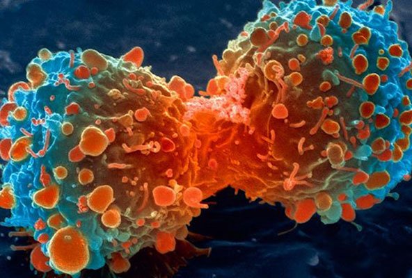 iPharmaCongress's tweet photo. New epigenetic drug strategy to treat cancer
#drugdiscovery #pharmaresearch  #iPharma2019
Learn more: https://t.co/LPh5oZr9t9
iPharma2019: https://t.co/nx18RnrAtW https://t.co/7CrjO7xPSU