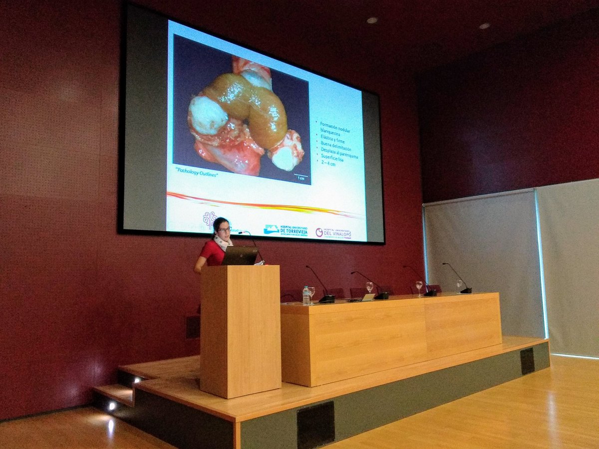 AnitaBuendia's tweet photo. I CURSO DE ACTUALIZACIÓN MULTIDISCIPLINAR EN UROPATOLOGÍA. Hospitales Universitarios del Vinalopó y Torrevieja. Tumor adenomatoide paratesticular. Dra. Soto García. @sortizreina @ReyPathology @apmur1 @SEAP_IAP https://t.co/pq8VJ00Ya1