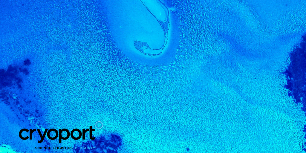 myCryoStork's tweet photo. We 're proud to have a network of over 380 domestic and international #IVF clinics. Visit our website to learn more, #CryoStork #IVFFertility https://t.co/aeV85v8iMD https://t.co/0FpnhU6MTn