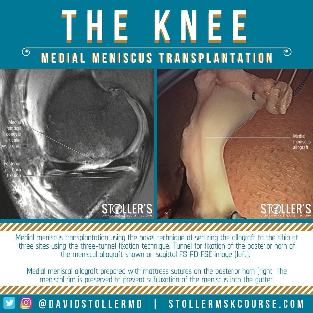 David W. Stoller, MD tweet media