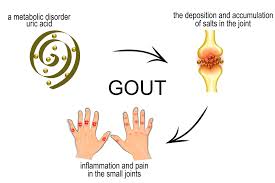 PEMFGUY's tweet photo. How PEMF Therapy works to heal Gout. https://t.co/BE8WTRfj0y 
#healing #pemf #gout #chronicillness #pain #chiropractic https://t.co/BfrGVVakhD